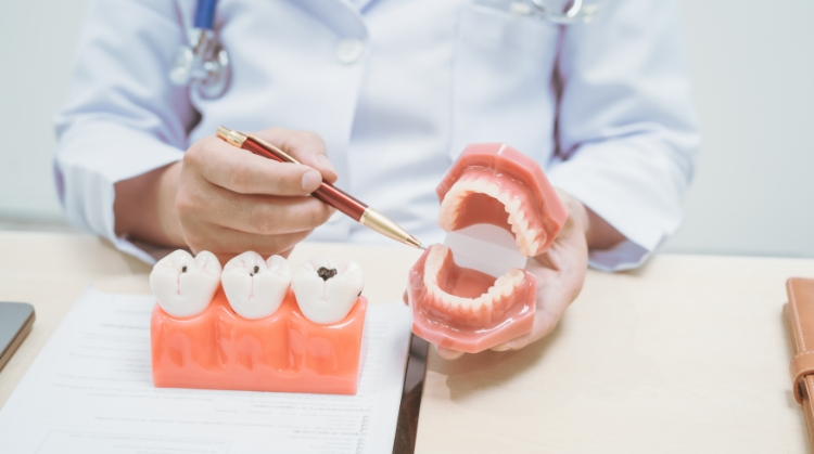 Dentist at On Q Dentistry in Portland, OR explaining cavity prevention and treatment using tooth and jaw models.